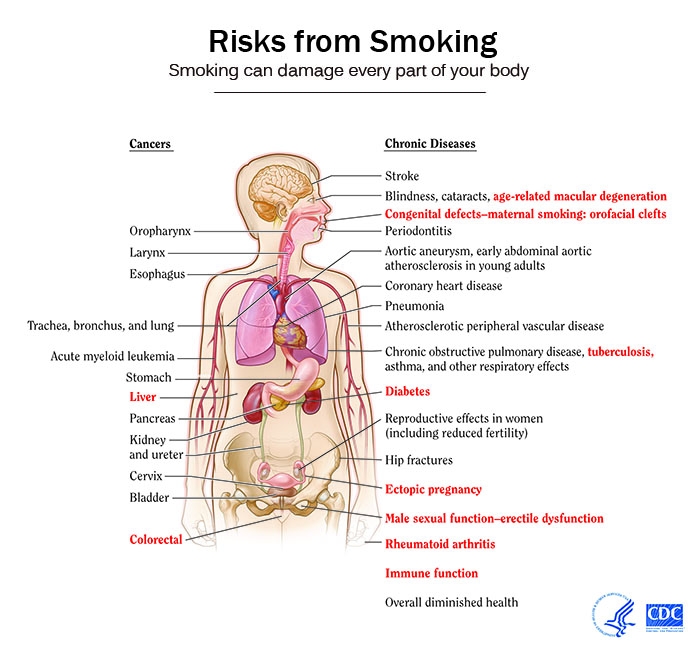 การสูบบุหรี่มีผลเสียต่อสุขภาพมากกว่าแค่เรื่องปอด เรามาเลิกบุหรี่กันนะคะ
